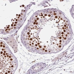 SMIM6 Antibody, Novus Biologicals 0.1mL; Unlabeled:Antibodies, Polyclonal